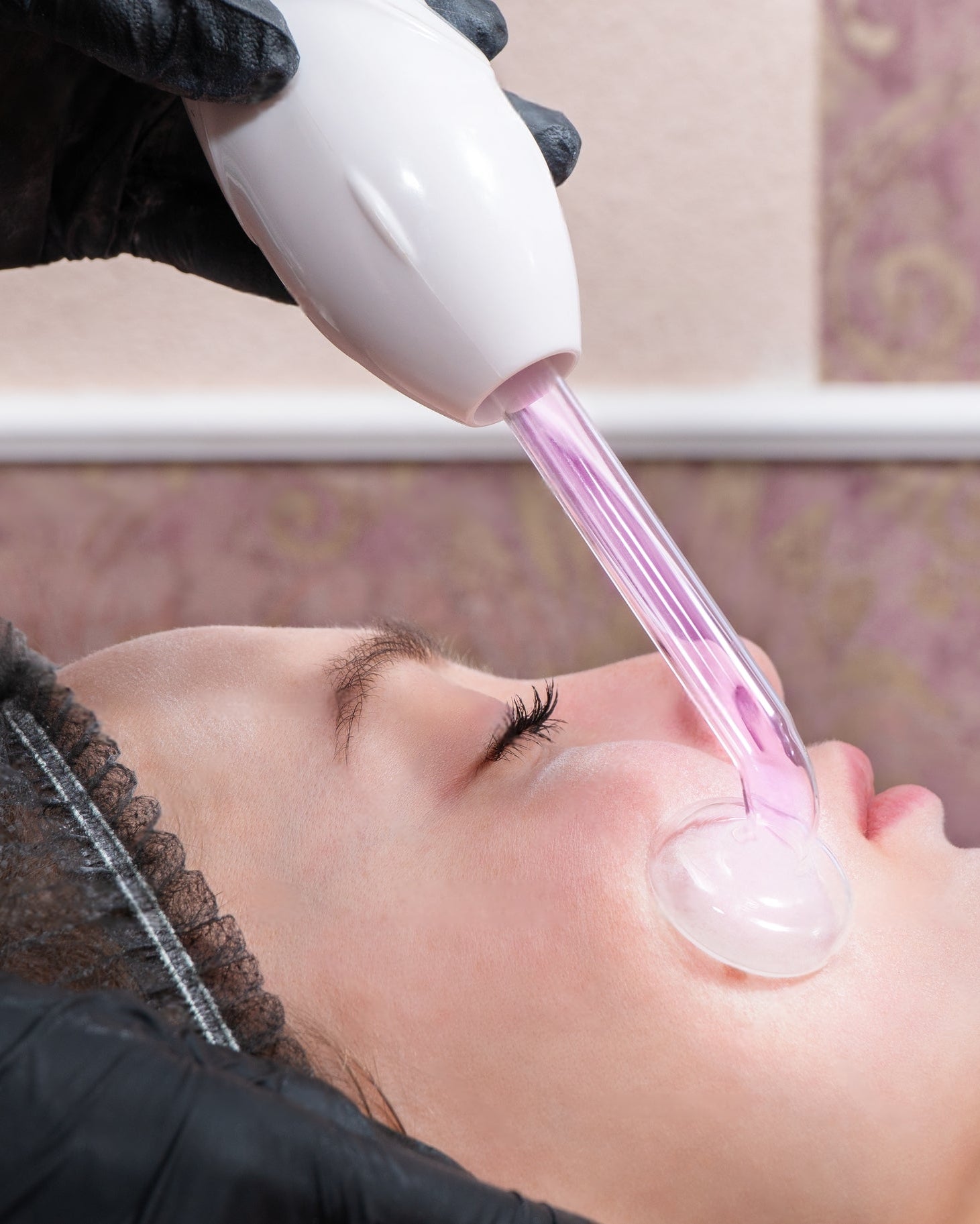 Woman receiving a high frequency wand treatment on her cheek for acne treatment
